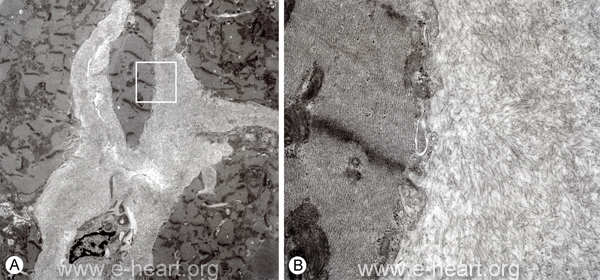 Amyloid TEM 01